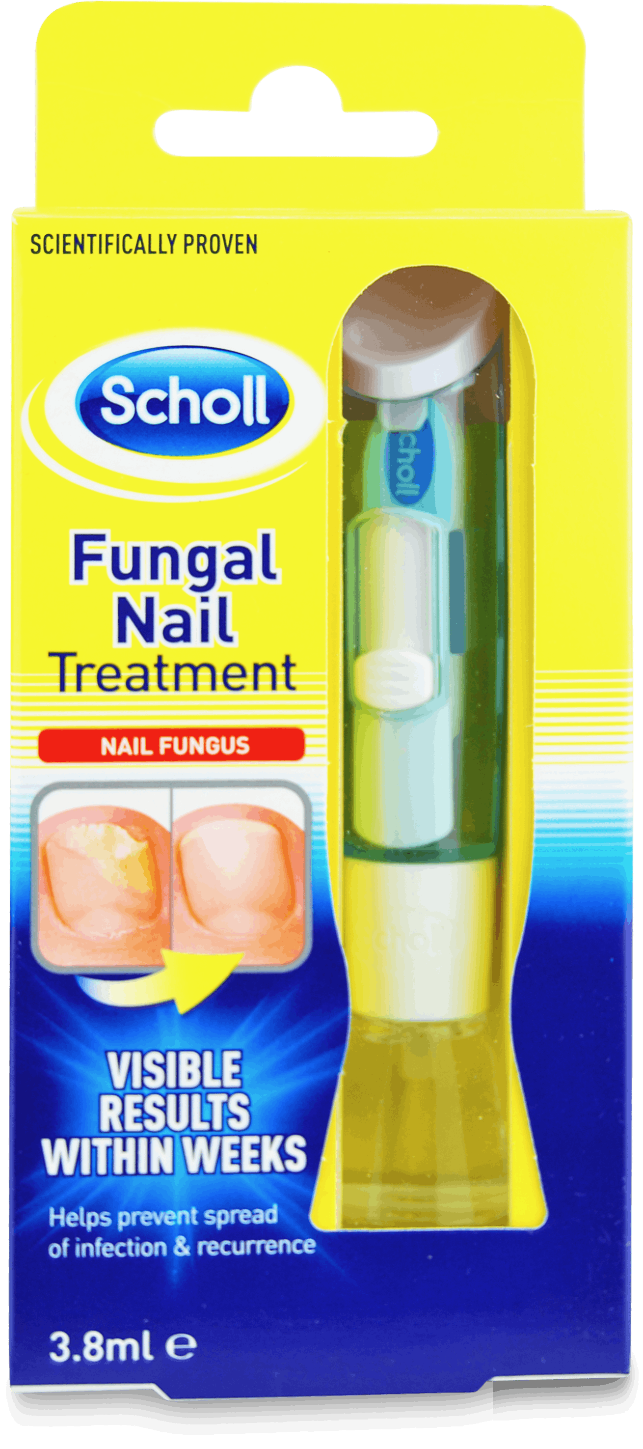 Scholl Fungal Nail Treatment - YouTube